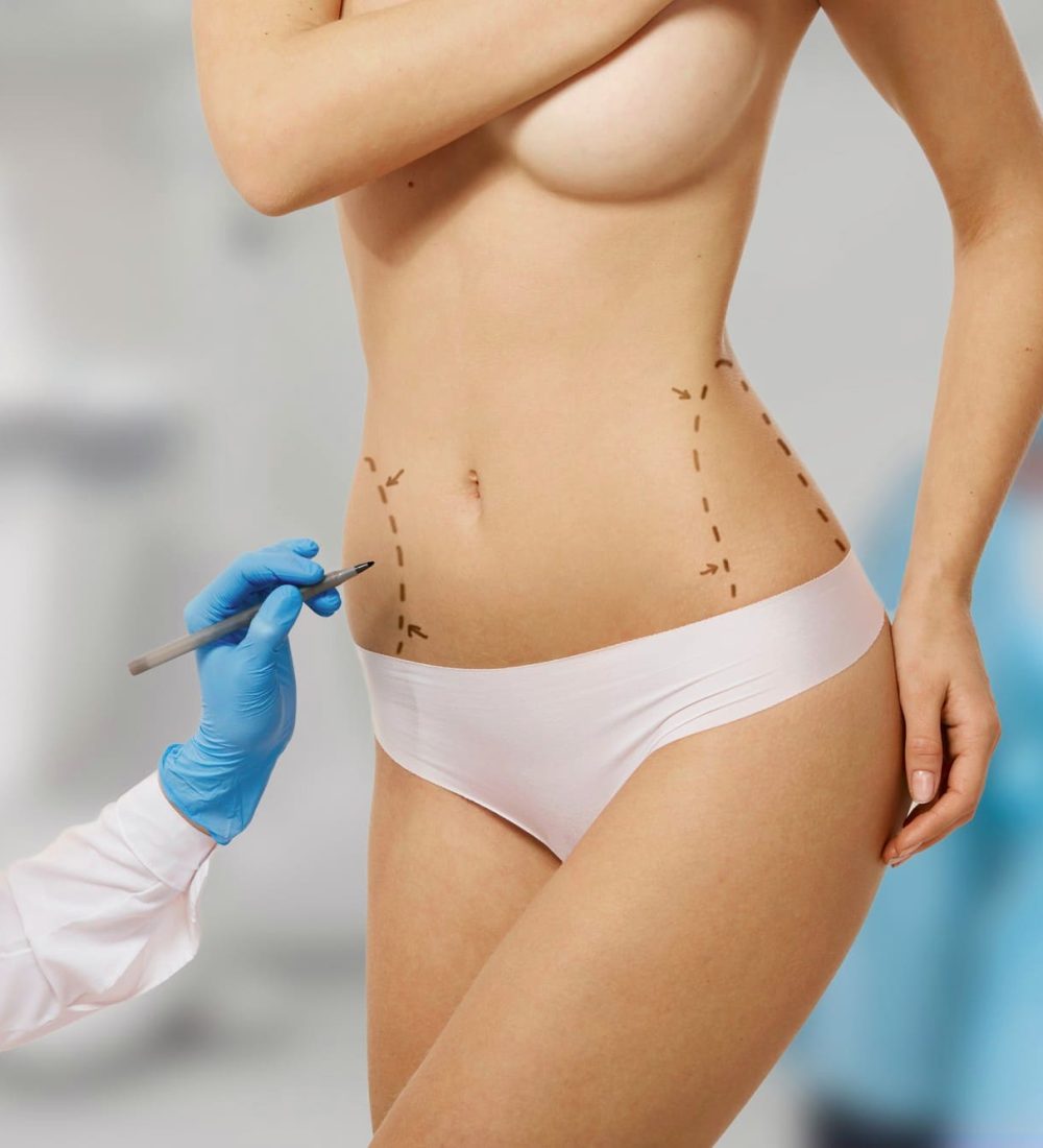 mujer-marcada-cirugia-estetica(1)